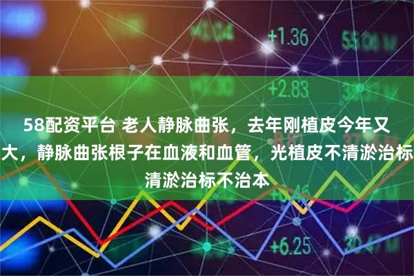 58配资平台 老人静脉曲张，去年刚植皮今年又烂鸡蛋大，静脉曲张根子在血液和血管，光植皮不清淤治标不治本
